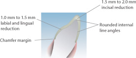 Lava - Anterior Crown