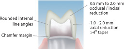 Lava - Posterior Crown